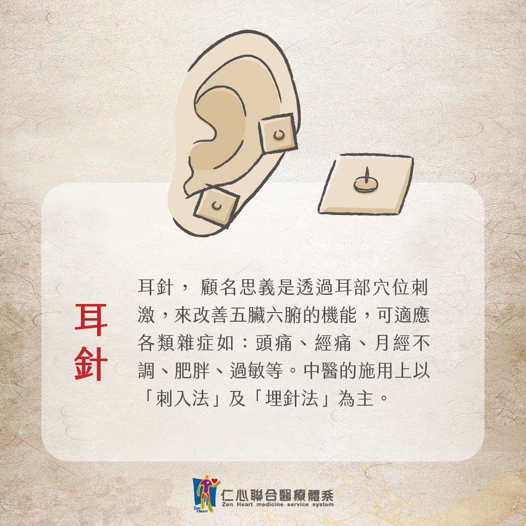 耳針